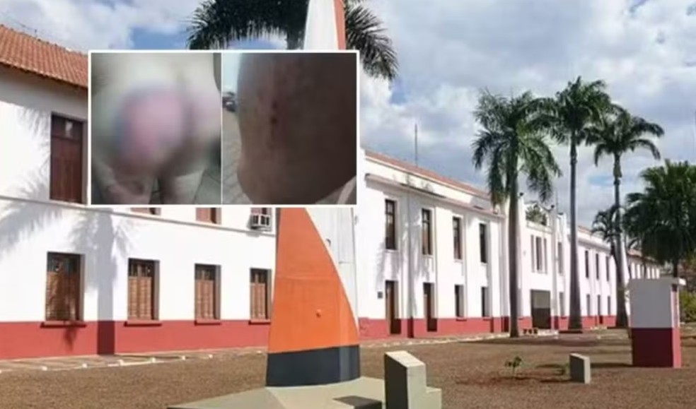 Ex-militar agredido durante “batismo” em quartel sofre com traumas e depende de medicação: “Que a Justiça seja feita”